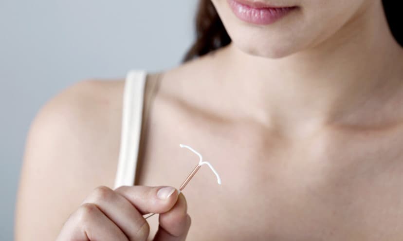 ¿Cómo sé si el DIU está colocado?